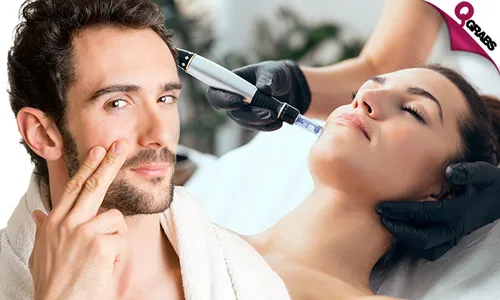 Full Face Dermapen Session!